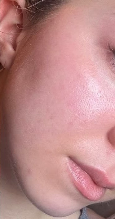 After 10 Nights